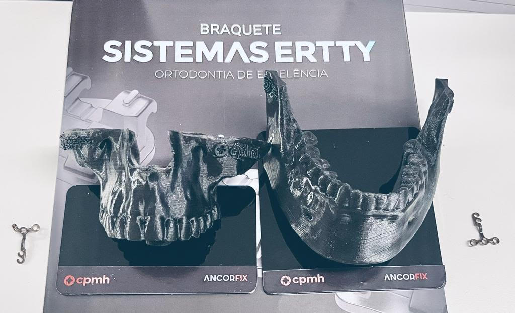 Sistemas Ertty