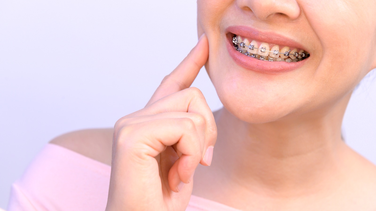 ORTODONCIA LAS CONDES ALINIEADORES ESTETICOS DISEÑO SONRISA ORTODONCIA ADULTO